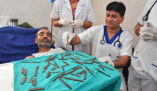 40 con dao được lấy ra từ bụng bệnh nhân người Ấn Độ