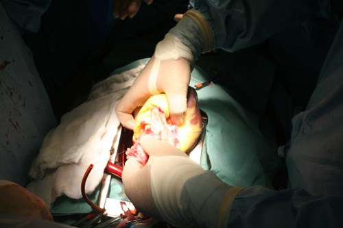 Vì sao bác sĩ 34 tuổi xứ Nghệ tự nguyện hiến mô, tạng cho bệnh nhân hiểm nghèo?