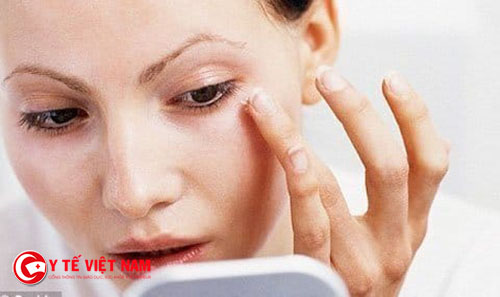 Chăm sóc vùng da quanh mắt như thế nào?