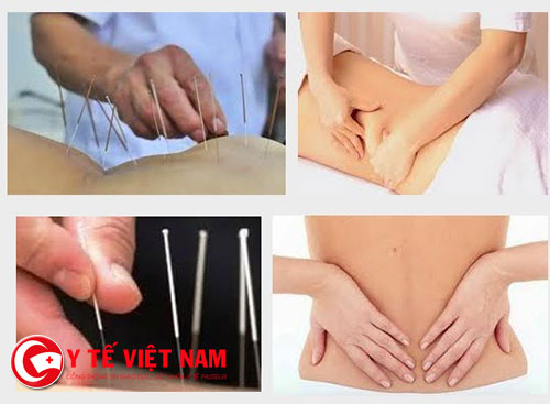 điều trị đau lưng bằng phương pháp châm cứu 