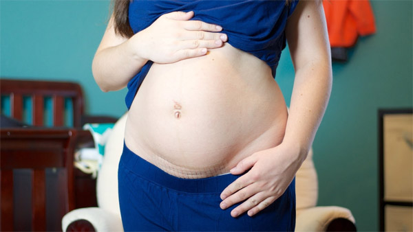 Cách giảm mỡ bụng sau sinh mổ