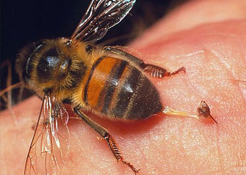 Bệnh nhân bị ong rừng đốt có nguy cơ suy đa phủ tạng, thậm chí là tử vong