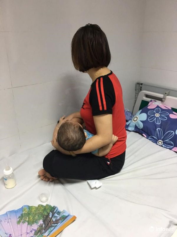 Trẻ bị sùi mào gà sau đang điều trị tại Bệnh viện Da liễu trung ương