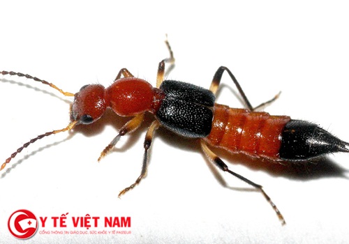 Dân chung cư ở Hà Nội lo lắng bất an vì kiến ba khoang tấn công