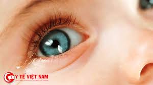 Một số cách trị bệnh đau mắt đỏ hiệu quả nhất
