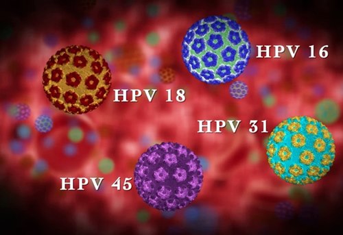 Mụn cơm do virus HPV gây nên