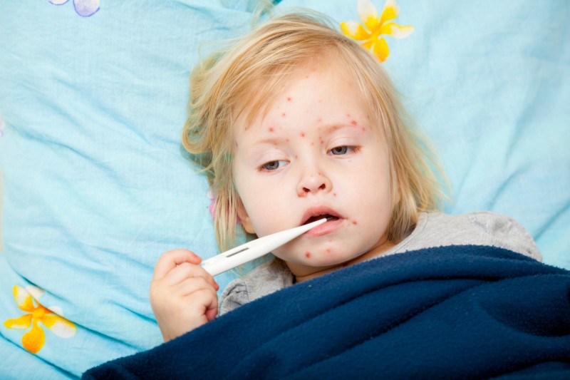 Trẻ em bị sốt xuất huyết sẽ có bị phát ban