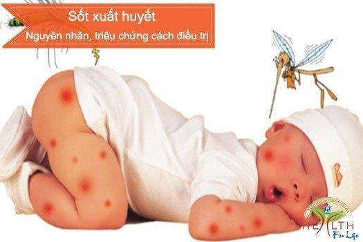 Những dấu hiệu nhận biết sớm nhất bệnh sốt xuất huyết