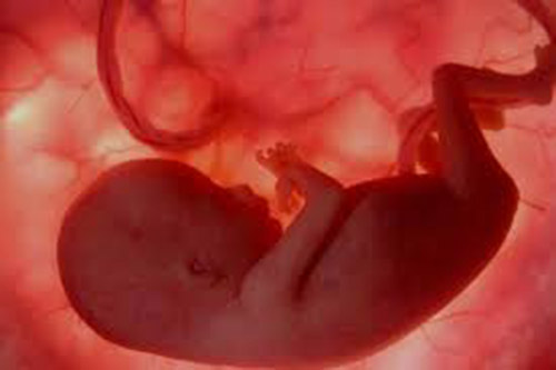 Không nghe thấy tim thai là dấu hiệu đầu tiên của việc thai nhi không phát triển trong tử cung