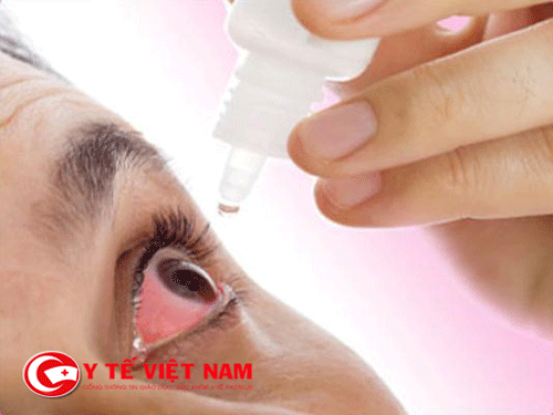 Thuốc chữa đau mắt đỏ hiệu quả nhất