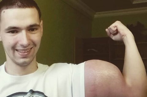 Bắp tay của Kirill Tereshin phồng lên rất đáng sợ. Ảnh: Daily Mail.