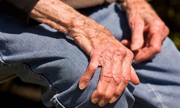 Bệnh Parkinson chủ yếu xảy ra ở người già