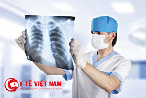 Việt Nam mỗi năm ghi nhận gần 24.000 trường hợp mắc ung thư phổi