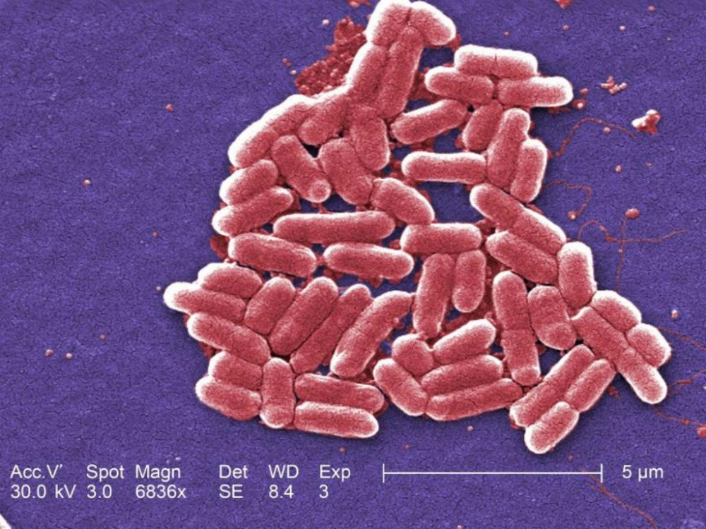 Sử dụng đa kháng sinh để tiêu diệt vi khuẩn E.coli siêu kháng thuốc?
