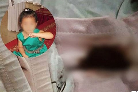 Cảnh báo: Mẹ đặt nhầm thuốc hạ sốt vào vùng kín của bé gái