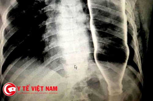 Điểm mặt chỉ tên những ca bệnh hi hữu nhất Việt Nam năm 2017