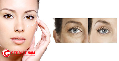Chăm sóc vùng da quanh mắt có nên dùng kem dưỡng chuyên biệt?