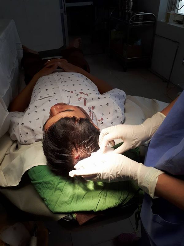 Bác sĩ BV Việt Yên, Bắc Giang bị đối tượng ném máy đo huyết áp vào đầu