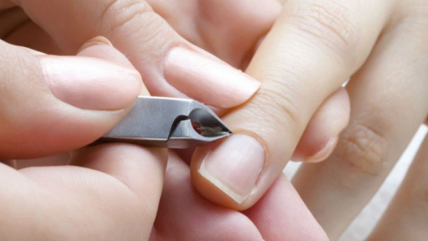 Đốm trắng xuất hiện trên móng tay của bạn tiết lộ bệnh nguy hiểm gì?