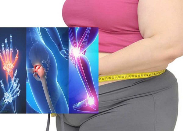 Thoái khóa khớp và béo phì gây ra những biến chứng gì cho cơ thể?