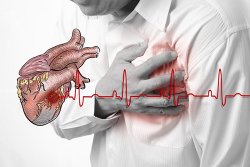 3 nguyên nhân chính gây bệnh suy tim ở người cao tuổi